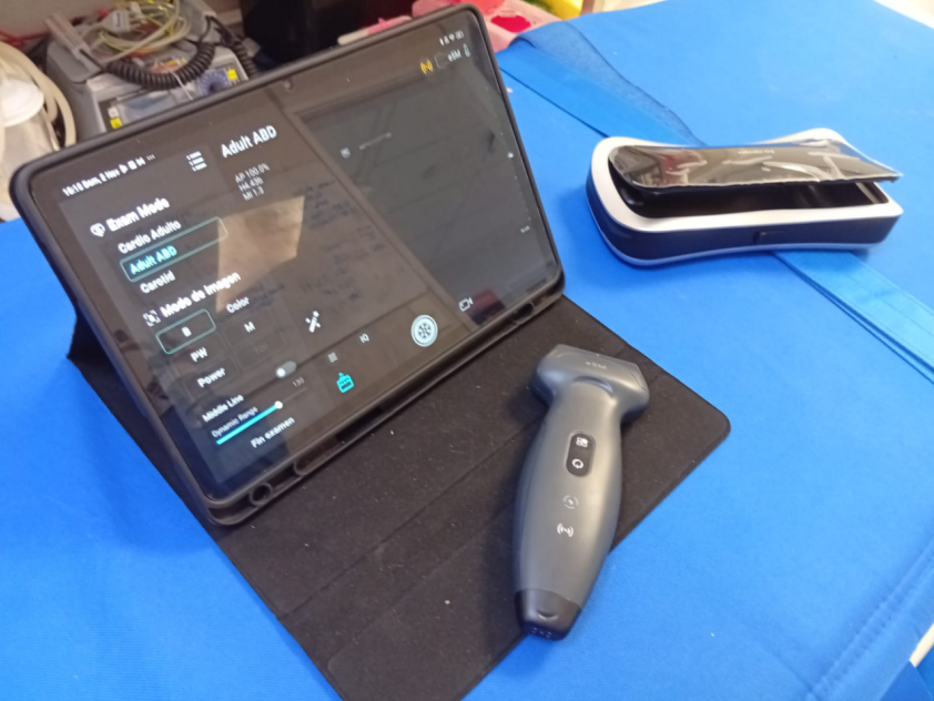 ecógrafo portátil de última generación